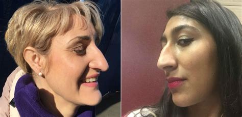 #SideNoseSelfie: People are proudly breaking down barriers with their big noses | IBTimes UK