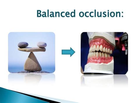 occlusal adjustment | PPT