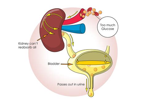 slmillustration - Functions of the Kidneys - Book illustration