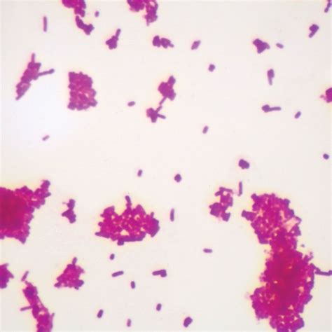 Escherichia coli Slide, w.m. | Carolina Biological Supply