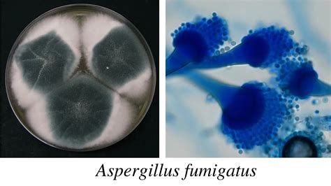 Aspergillus: Morphology, Clinical Features, and Lab Diagnosis • Microbe Online