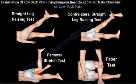 Clinical Examination for Low Back Ache — OrthopaedicPrinciples.com