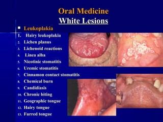 White lesions | PPT