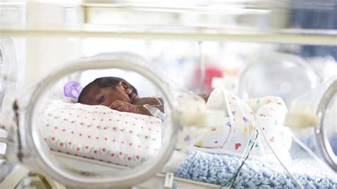 Premature Babies: Definition, Characteristics and More