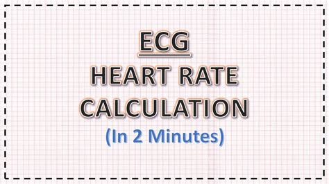 how to measure rate on ecg - shapovmusic.com