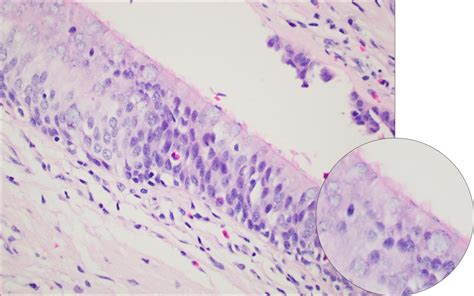 Bronchus – Normal Histology – NUS Pathweb :: NUS Pathweb