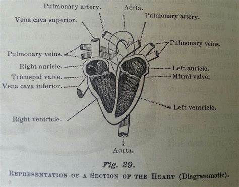 Heart Disease Drawing at PaintingValley.com | Explore collection of ...