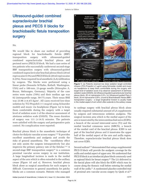 (PDF) Ultrasound-guided combined supraclavicular brachial plexus and ...