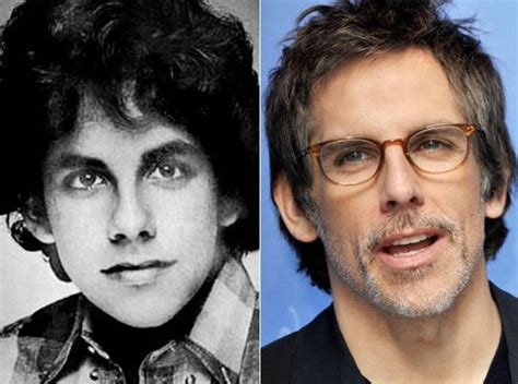 Ben Stiller before and after plastic surgery (32) – Celebrity plastic ...