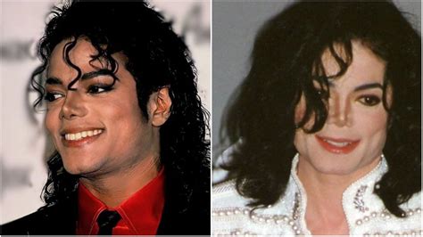 Did Michael Jackson Bleach His Skin? Star’s Skin Condition Explored