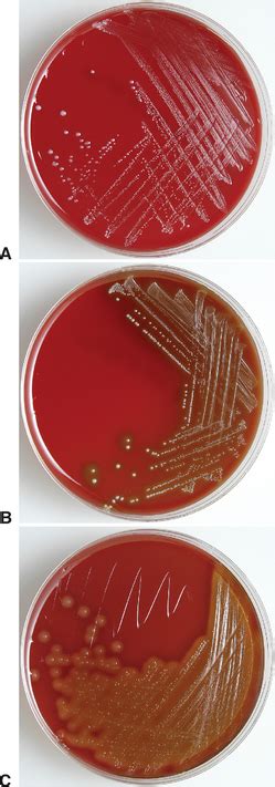 Streptococcus Salivarius Hemolysis