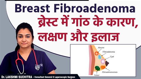 What Is Breast Fibroadenoma In Hindi || Fibroadenoma Symptoms and ...