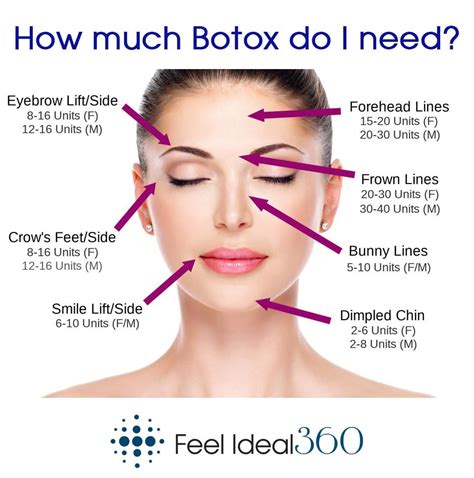 Botox Before And After 40 Units | Before And After