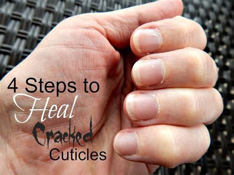 4 Steps to Heal Cracked Cuticles - ALL NATURAL steps to heal your ...