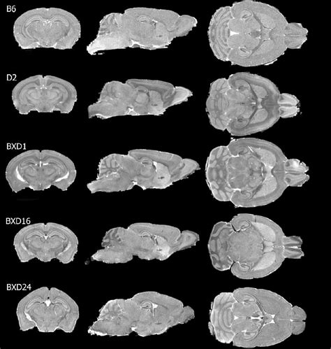 Figure 2 from Genetic dissection of the mouse brain using high-field magnetic resonance ...