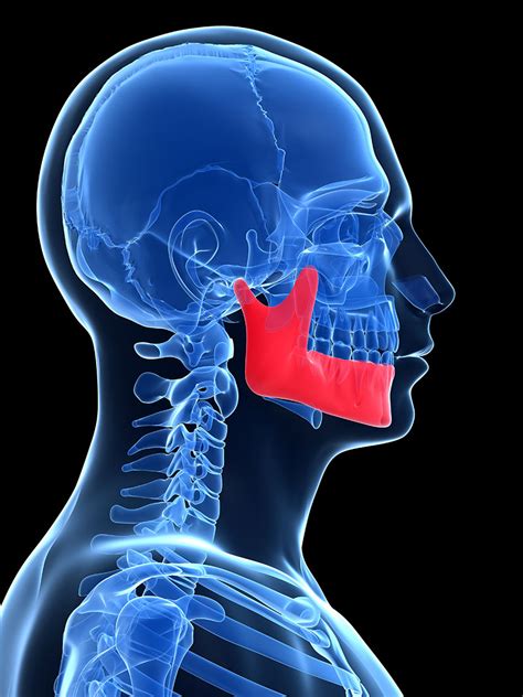 Diagnosing Bone Loss - Pasadena Family Cosmetic and Implant ...