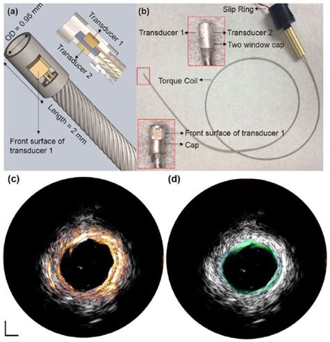 (a) Diagram of back-to-back multi-frequency IVUS catheter. Middle: 3D... | Download Scientific ...