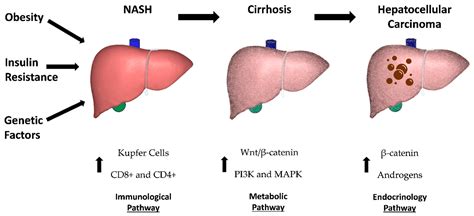 Biomedicines | Free Full-Text | Natural Progression of Non-Alcoholic ...