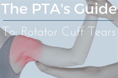 The Complete Rotator Cuff Tear Guide for Physical Therapy Assistants (2022)