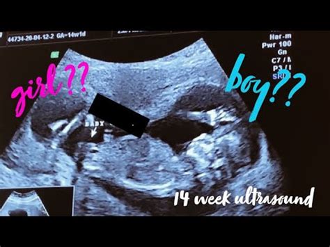 14 WEEK 3D ULTRASOUND GENDER REVEAL ! - YouTube