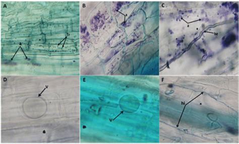 The different structures of arbuscular mycorrhizae on the roots of... | Download Scientific Diagram