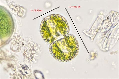 Cosmarium | The Microscopic Life of Shetland Lochs