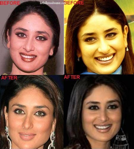 Kareena Kapoor's nose job - Hawk Search