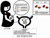 胎児RhD血液型を判定、新たな出生前胎児遺伝学的検査を開発－成育医療センターら  QLifePro 医療ニュース sketch template