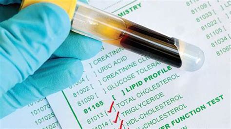 Determination of Cholesterol Level in Human Serum - Enzymatic ...