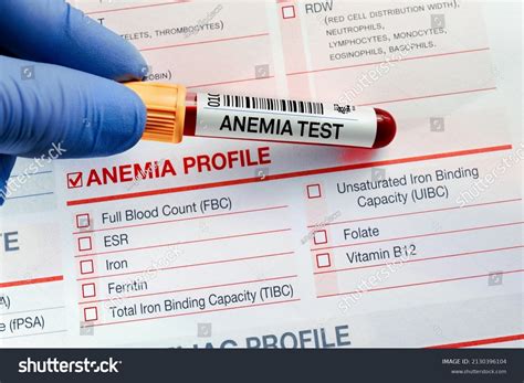 Blood Sample Analysis Anemia Profile TestẢnh có sẵn2130396104 ...