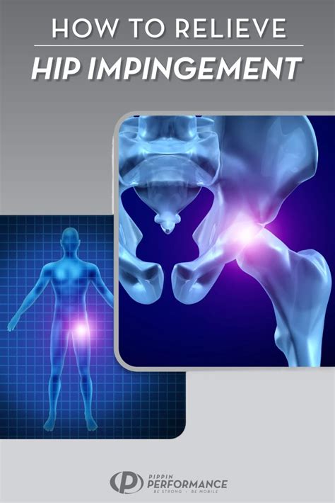 Hip Impingement Fast Fix in 2024 | Hip impingement exercises ...