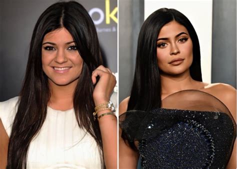 These Before And After Photos Of Kylie Jenner Will Have You Doing A Double Take | Celebrity Insider