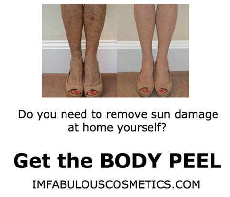 TCA PEELS INFO & REVIEWS: Body Peel, TCA Chemical Peel for Home Use, Sun Damage and brown spots.