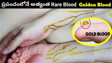 Golden Blood Clearly Explained|| Only 43 people in the World have it | Rarest blood | MickyZone ...