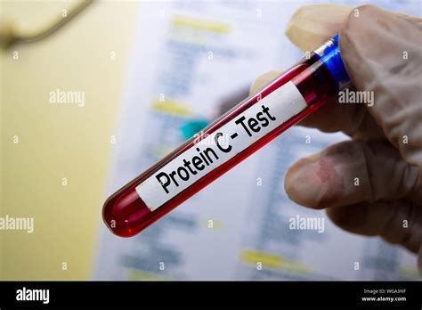 C peptide test hi-res stock photography and images - Alamy