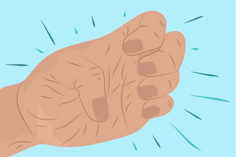 Difficulty Making a Fist Is an Early Rheumatoid Arthritis Risk Factor