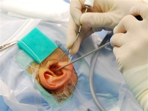 Ear Surgeries - Aahan ENT Clinic - Dr.Ajay Doiphode