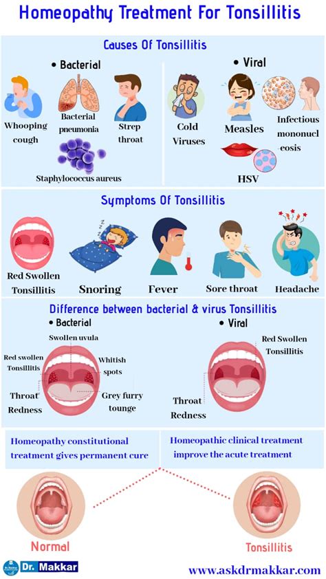 Tonsillitis Pathophysiology