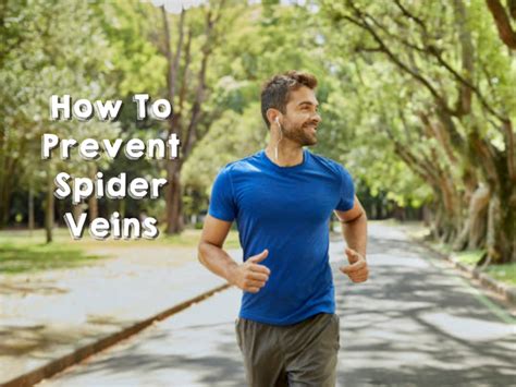 Spider Veins In Singapore: Treatment And Prevention Tips | Red Zone Media