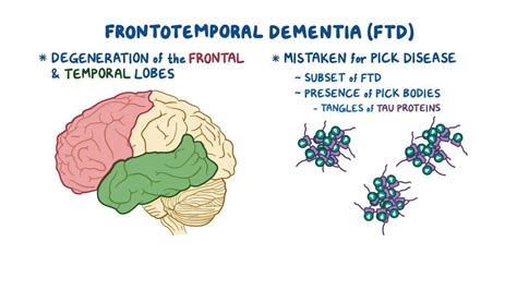 Frontotemporal dementia: Video, Anatomy & Definition | Osmosis