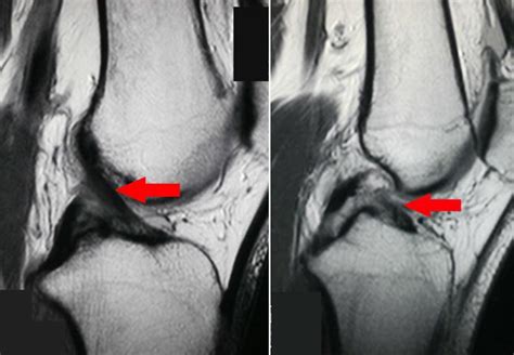 X-rays, CT Scans, and MRI Scans - OrthoInfo - AAOS