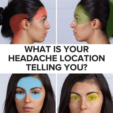 7 Pressure Points To Help With Headaches [Video] | Headache remedies ...