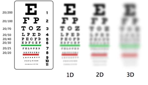 20/20 EYE GLASSES: Visual Acuity