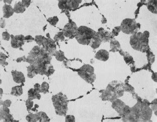 The Structure and Rate of Formation of Pearlite | SpringerLink