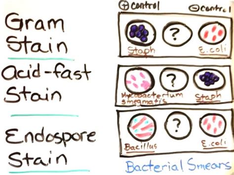 microbiology - Are acid-fast bacteria Gram-positive or Gram-negative ...