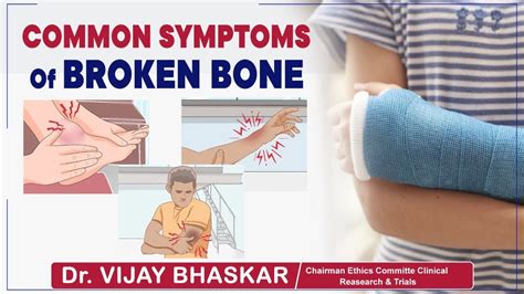 Symptoms of Broken Bone || Bone Fracture Signs || Dr Vijay Bhaskar ...