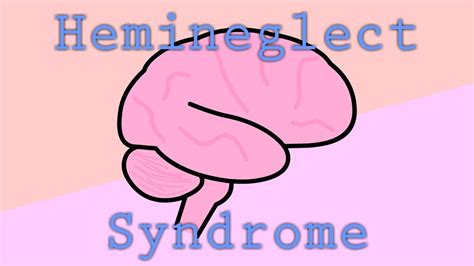 When An Injured Brain Ignores Half The World | Hemineglect Syndrome - YouTube