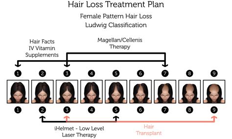 Female Pattern Hair Loss Treatment | Rejuvence Clinic