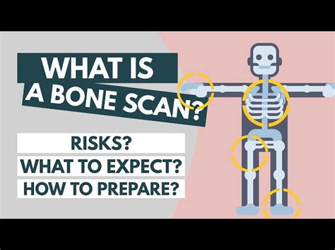 Bone Scan: Procedure, Risks, and What to Expect | SchoolTube