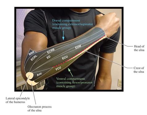 BRR, Brachioradialis ECRB, extensor carpi radialis brevis; ECRL, extensor carpi radialis longus ...